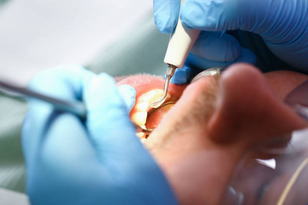 Best Emergency Orthodontic Repairs in Punta Rassa, FL