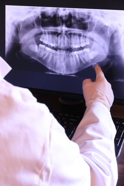 Best Emergency Care for Gum Disease in Punta Rassa, FL