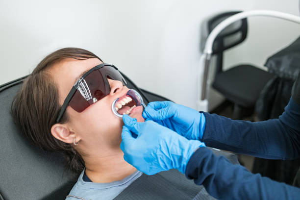 Best Knocked-Out Tooth (Avulsed Tooth) Treatment in Punta Rassa, FL